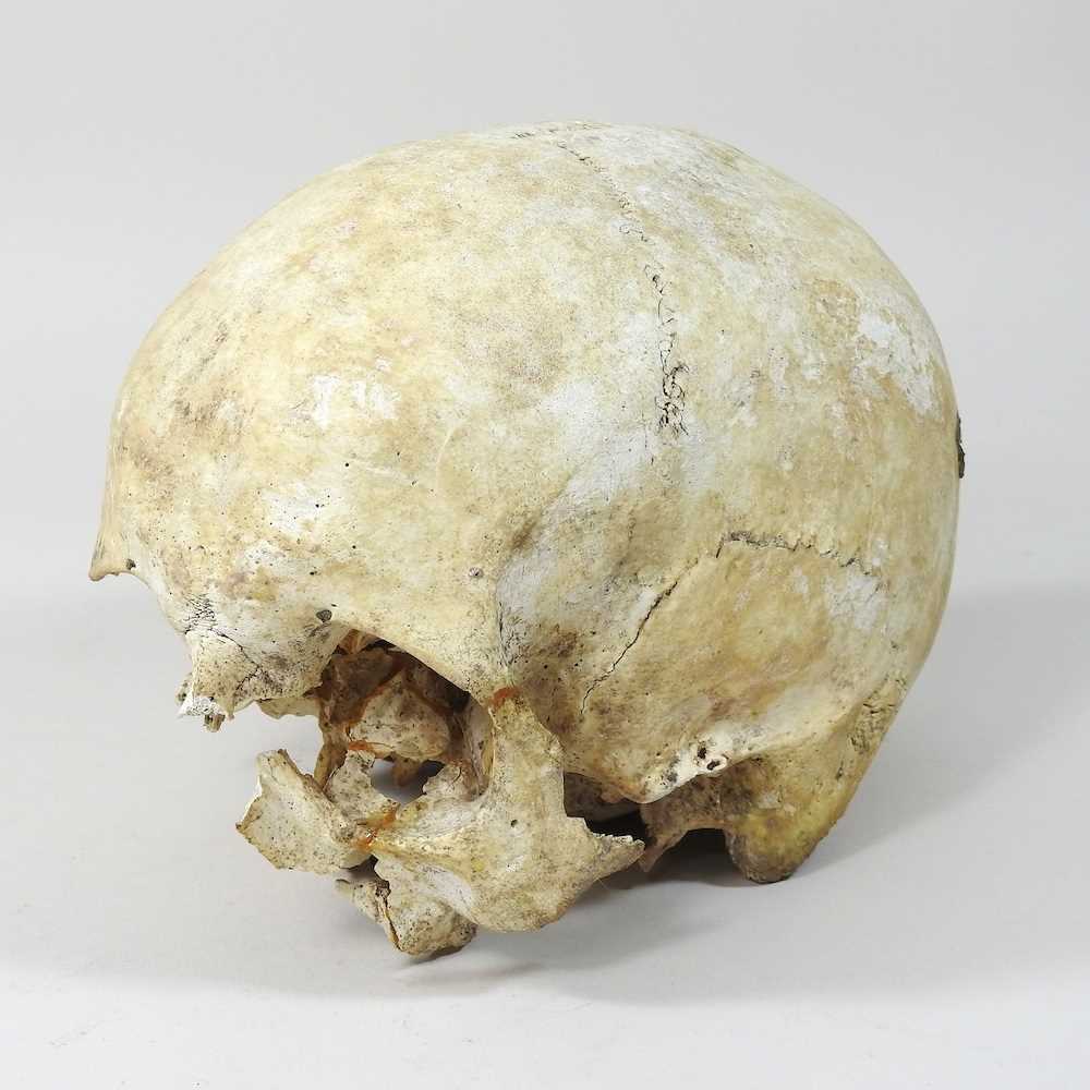 Lot 294 - A partial human skull