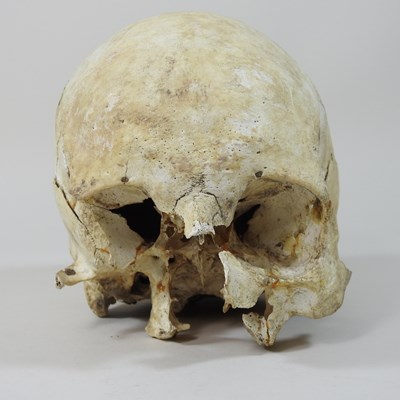 Lot 294 - A partial human skull