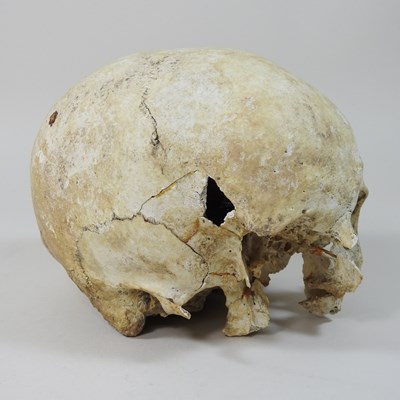 Lot 294 - A partial human skull