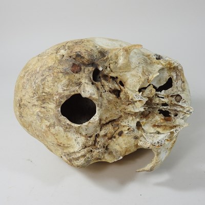 Lot 294 - A partial human skull